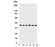 Western blot testing of Cdk7 antibody and Lane 1:  rat testis;  2: rat ovary;  3: HeLa;  4: MCF-7;  5: A549;  6: COLO320 cell lysate. Predicted molecular weight: ~37kDa.