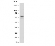 Western blot testing of P2X7 antibody and human U87-MG cell lysate.  Expected molecular weight: 65~85 kDa depending on glycosylation level.