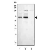 Western blot testing of human 1) A431, 2) HepG2 and 3) MCF7 cell lysate with PCSK9 antibody. Predicted molecular weight: ~74 kDa (pro form), ~64 kDa (mature form).