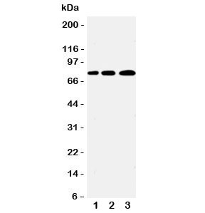 Western blot testing of PLK2 antibody and Lane 1: A431; 2: 293T; 3: COLO320 cell lysate