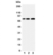 Western blot testing of PLK2 antibody and Lane 1:  A431;  2: 293T;  3: COLO320 cell lysate. Predicted molecular weight ~78 kDa.