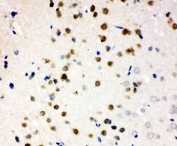 IHC-P testing of PLK2 antibody and rat brain tissue. HIER: steam section in pH6 citrate buffer for 20 min and allow to cool prior to staining.