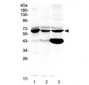 Western blot testing of human 1) 293T, 2) MCF7 and 3) MDA-MB-231 cell lysate with PTH1R antibody at 0.5ug/ml. Expected molecular weight ~66 kDa (unmodified), 85-95 kDa (glycosylated).