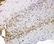IHC staining of FFPE rat brain tissue with Syndecan 3 antibody. HIER: boil tissue sections in pH8 EDTA for 20 min and allow to cool before testing.