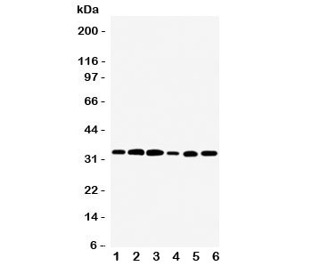 Western blot testing of TAZ antibody and rat samples 1: skeletal muscle; 2: heart; 3: liver; and human samples 4: HeLa; 5: SMMC-7721; 6: SCG cell lysate. Expected/observed size ~33KD