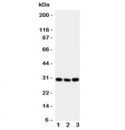 Western blot testing of Cd134 antibody and mouse samples 1:  brain;  2: spleen;  3: liver tissue lysate.  Expected molecular weight: 29-50 kDa depending on glcyosylation level.