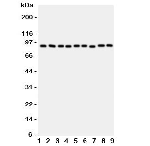 Western blot testing of VCP antibody and rat samples 1: brain; 2: kidney; 3: liver; 4: lung; and human samples 5: HeLa; 6: HL-60; 7: A431; 8: A549; 9: SMMC-7721 cell lysate. Expected/observed size ~89KD