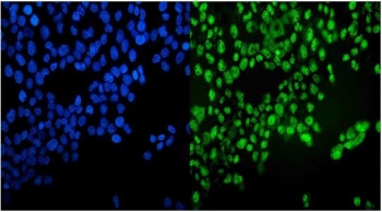 Immunofluorescent staining of FFPE human A549 cells with VCP antibody (green) and DAPI nuclear stain (blue). HIER: steam section in pH6 citrate buffer for 20 min.