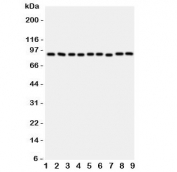 Western blot testing of VCP antibody and rat samples 1: brain;  2: kidney;  3: liver;  4: lung; and human samples  5: HeLa;  6: HL-60;  7: A431;  8: A549;  9: SMMC-7721 cell lysate.  Predicted/observed molecular weight: ~89/97 kDa.
