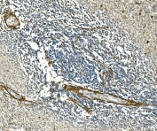 IHC staining of FFPE human spleen tissue with COL1A1 antibody. HIER: boil tissue sections in pH8 EDTA for 20 min and allow to cool before testing.