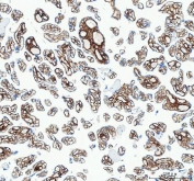 IHC staining of FFPE human placental tissue with Collagen 1 antibody. HIER: boil tissue sections in pH8 EDTA for 20 min and allow to cool before testing.