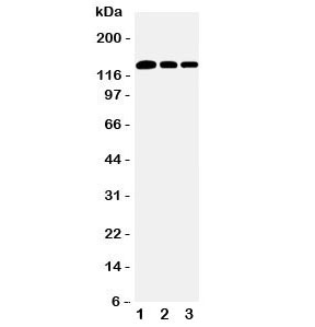 Western blot testing of Collagen type 1 antibody and Lane 1: rat lung; 2: human placenta; 3: rat testis tissue lysate. Expected molecular weight: 140-210 kDa (precusor), 70-90 kDa (mature).