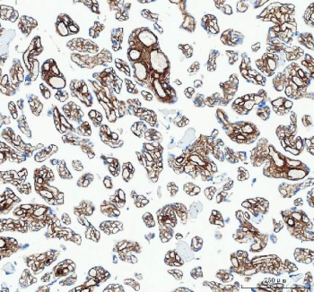 IHC-F testing of Collagen type 1 antibody and human placenta tissue