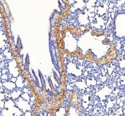 IHC staining of FFPE rat lung tissue with Collagen 1 antibody. HIER: boil tissue sections in pH8 EDTA for 20 min and allow to cool before testing.