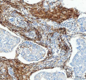 IHC staining of FFPE rat lung tissue with Collagen 1 antibody. HIER: boil tissue sections in pH8 EDTA for 20 min and allow to cool before testing.