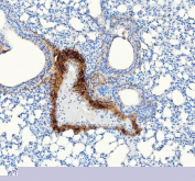 IHC staining of FFPE mouse lung tissue with Collagen 1 antibody, HRP secondary and DAB substrate. HIER: boil tissue sections in pH8 EDTA for 20 min and allow to cool before testing.
