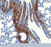 IHC staining of FFPE rat lung tissue with Collagen 1 antibody, HRP secondary and DAB substrate. HIER: boil tissue sections in pH8 EDTA for 20 min and allow to cool before testing.