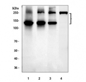Western blot testing of 1) human placenta, 2) rat skin, 3) mouse skin and 4) mouse NIH 3T3 cell lysate with Collagen 1 antibody. Expected molecular weight: 140-210 kDa (precusor), 70-90 kDa (mature).