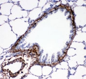 IHC-P: Collagen 1 antibody testing of rat lung tissue. HIER: boil tissue sections in pH6, 10mM citrate buffer, for 10-20 min and allow to cool before testing.