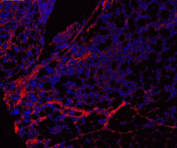 Immunofluorescent staining of FFPE human tonsil tissue with Collagen 1 antibody (red) and DAPI counterstain (blue). HIER: boil tissue sections in pH6 citrate buffer for 10-20 min and allow to cool before testing.