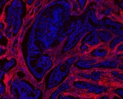 Immunofluorescent staining of FFPE human breast tissue with Collagen 1 antibody (red) and DAPI counterstain (blue). HIER: boil tissue sections in pH6, 10mM citrate buffer, for 10-20 min and allow to cool before testing.