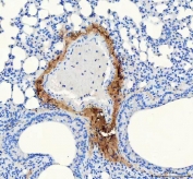 IHC staining of FFPE mouse lung tissue with Collagen 1 antibody. HIER: boil tissue sections in pH8 EDTA for 20 min and allow to cool before testing.
