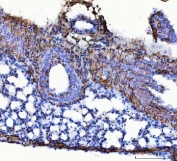 IHC-P: Collagen 1 antibody testing of mouse lung tissue at 2ug/ml. HIER: boil tissue sections in pH6, 10mM citrate buffer, for 10-20 min and allow to cool before testing.