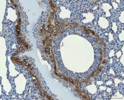 IHC-P: Collagen 1 antibody testing of rat lung tissue at 2ug/ml. HIER: boil tissue sections in pH6, 10mM citrate buffer, for 10-20 min and allow to cool before testing.