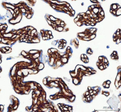 IHC staining of FFPE human placental tissue with Collagen 1 antibody, HRP secondary and DAB substrate. HIER: boil tissue sections in pH8 EDTA for 20 min and allow to cool before testing.