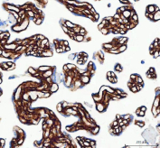 IHC-P: Collagen 1 antibody testing of rat lung tissue at 2ug/ml. HIER: boil tissue sections in pH6, 10mM citrate buffer, for 10-20 min and allow to cool before testing.