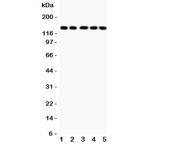 Western blot testing of Collagen Type 2 antibody and Lane 1: COLO320; 2: HeLa; 3: MCF-7; 4: A549; 5: Jurkat lysate. Expected/observed size ~140KD
