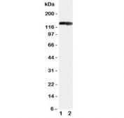 Western blot testing of COL2A1 antibody and Lane 1:  rat heart;  2: rat brain tissue lysate. Predicted molecular weight ~140 kDa.