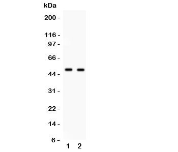 Western blot testing of E2F3 antibody and 1. HeLa, 2. COLO320 cell lysate. Expected/observed size ~49KD