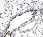 IHC-P: FGFR3 antibody testing of rat lung tissue