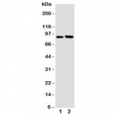 Western blot testing of FGFR3 antibody and Lane 1:  U87;  2: SGC cell lysate. Predicted molecular weight: 87-135 kDa depending on glycosylation level.