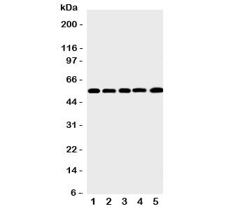 Western blot testing of MMP12 antibody and Lane 1: human SMMC-7721; 2: mouse HEPA; 3: (h) HeLa; 4: (h) K562; 5: (h) MCF-7 cell lysate