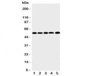 Western blot testing of MMP12 antibody and Lane 1:  human SMMC-7721;  2: mouse HEPA;  3: (h) HeLa;  4: (h) K562;  5: (h) MCF-7 cell lysate. Predicted molecular weight: ~55 kDa (pro form), ~45 kDa and ~22 kDa (active forms).