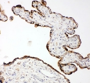IHC-P: MMP14 antibody testing of human placenta tissue