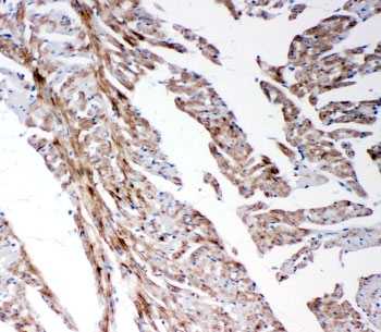 IHC-P: MMP14 antibody testing of rat heart tissue
