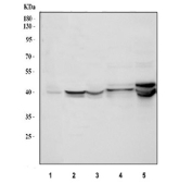 Western blot analysis using NDRG2 antibody. Lane 1: human HepG2 whole cell lysate; Lane 2: rat brain tissue lysate; Lane 3: rat heart tissue lysate; Lane 4: mouse brain tissue lysate; Lane 5: mouse heart tissue lysate. NDRG2 antibody detects a band at approximately 41 kDa, consistent with the predicted molecular weight of N-myc downstream regulated gene 2. A closely spaced doublet can be observed, likely reflecting post-translationally modified forms of NDRG2.