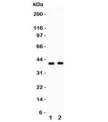 Western blot testing of NDRG2 antibody and Lane 1: SMMC-7721; 2: PANC lysate. Expected/observed size ~40KD