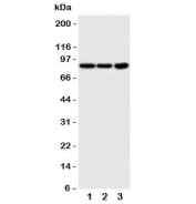 Western blot testing of TrkA antibody and Lane 1:  COLO320;  2: HT1080;  3: U87 cell lysate.  Observed molecular weight: 85~140 kDa depending on glycosylation level.