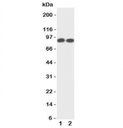 Western blot testing of TrkA antibody and Lane 1:  rat brain;  2: mouse brain tissue lysate. Observed molecular weight: 85~140 kDa depending on glycosylation level.
