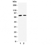 Western blot testing of Transglutaminase 2 antibody and Lane 1:  Jurkat;  2: HeLa cell lysate.  Predicted/observed molecular weight: ~ 78kDa.