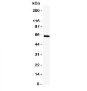 Western blot testing of TRAF5 antibody and human K562 cell lysate. Expected molecular weight ~64 kDa.
