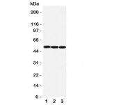 Western blot testing of beta Arrestin 1 antibody and Lane 1:  rat lung;  2: rat skeletal muscle;  3: human SW620 cell lysate. Predicted molecular weight ~51 kDa.