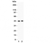 Western blot testing of E2F4 antibody and Lane 1:  rat lung;  2: human SMMC-7721 lysate.  Expected molecular weight ~44 kDa (unmodified) and 60-65 kDa (phosphorylated).