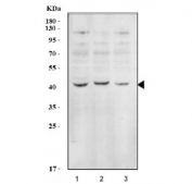 Western blot testing of human 1) HepG2, 2) 293T and 3) Raji cell lysate with EIF2B antibody.  Expected molecular weight: ~38 kDa.