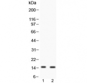 Western blot testing of 1) human COLO320 and 2) human SW620 cell lysate with FABP6 antibody at 0.5ug/ml. Expected molecular weight: ~15 kDa (isoform 1) and ~20 kDa (isoform 2).