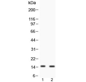 Western blot testing of 1) human COLO320 and 2) human SW620 cell lysate with FABP6 antibody at 0.5ug/ml. Expected molecular weight: ~15 kDa (isoform 1) and ~20 kDa (isoform 2).